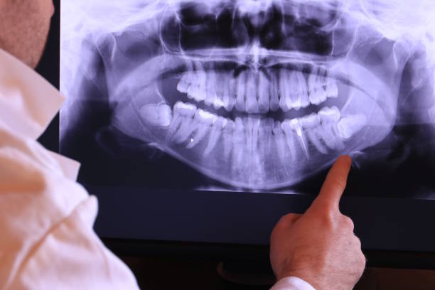 Best Pediatric Emergency Dentist in Spring Hope, NC