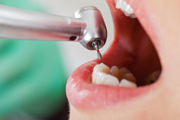 Best Orthodontic Emergency Dentist in Spring Hope, NC